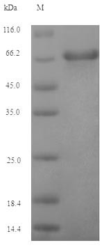 Envelope glycoprotein GP350 (BLLF1), partial, Epstein-Barr virus, recombinant