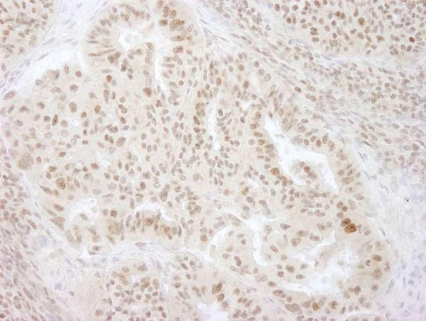 Anti-KIFC1 (IHC)