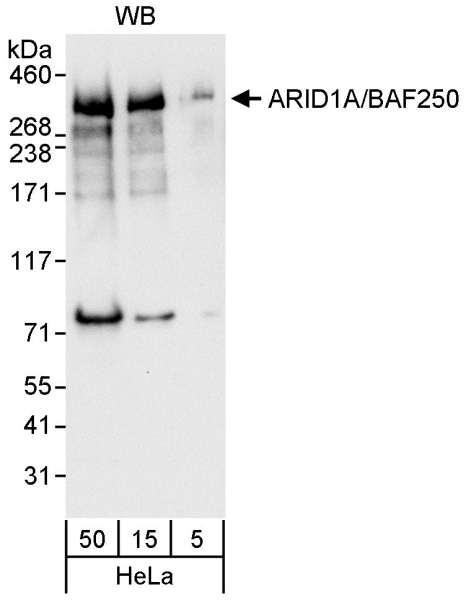 Anti-ARID1A/BAF250