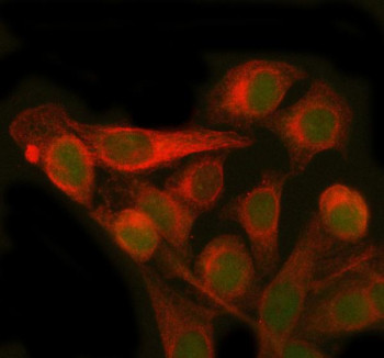 Anti-PMM2 / Phosphomannomutase 2