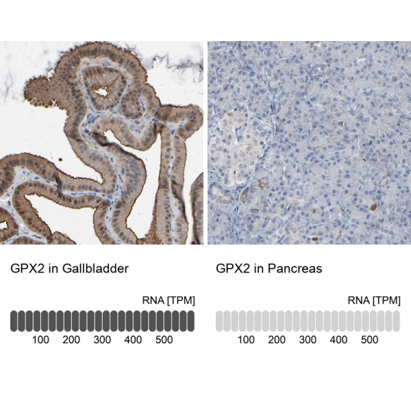 Anti-GPX2
