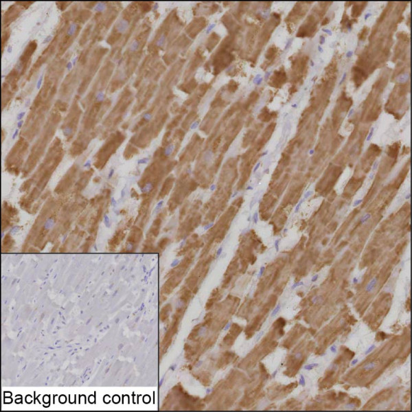 Anti-ATP5PD