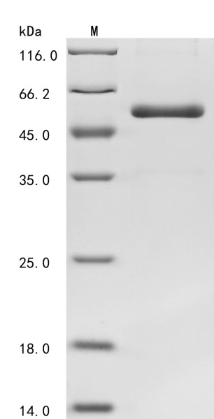 Lysyl oxidase homolog 1 (LOXL1), partial, human, recombinant