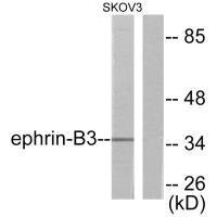 Anti-EFNB3