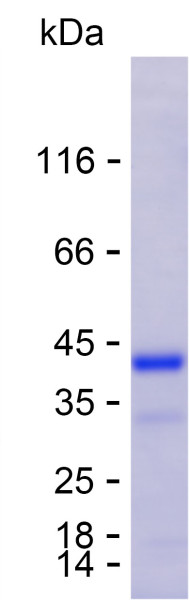 Recombinant Chikungunya virus E2 Protein