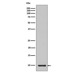 Anti-IGF-1 / Insulin like Growth Factor 1, clone DBG-9