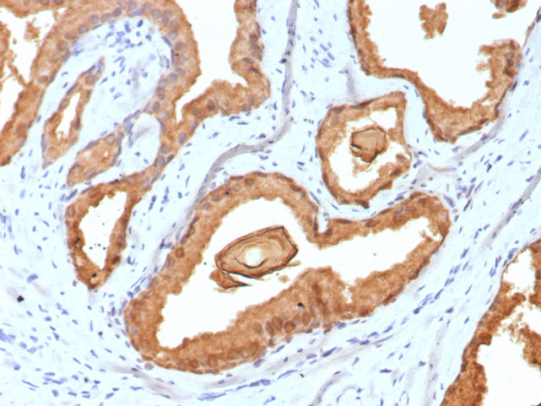 Anti-Prostate Specific Antigen (PSA), recombinant antibody, clone rKLK3/6947
