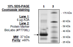 Adenosine Deaminase (ADA), recombinant S. putrefaciens protein, N-terminal His tag