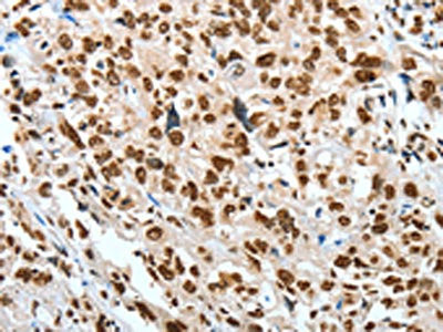 Anti-BNIP1