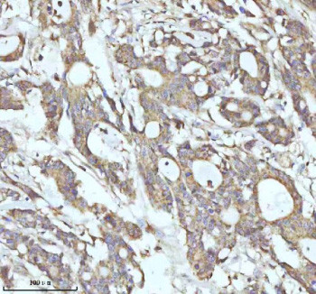 Anti-MALSU1 / Mitochondrial assembly of ribosomal large subunit protein 1