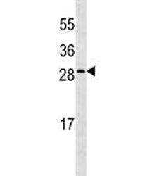 Anti-CRP (C-Reactive Protein), clone 506CT15.5.3
