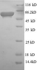 Aerobic glycerol-3-phosphate dehydrogenase (glpD), Escherichia coli, recombinant