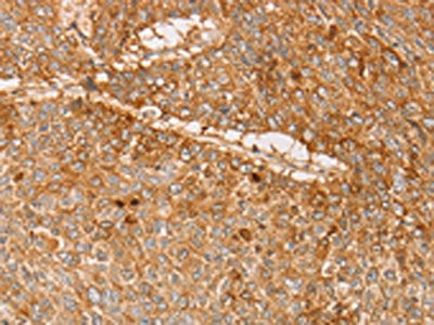 Anti-PACSIN2