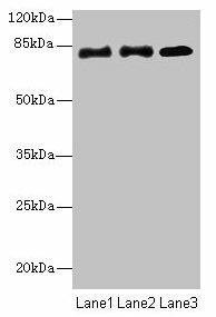 Anti-CPEB4