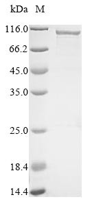 Cartilage intermediate layer protein 1 (CILP), partial, human, recombinant
