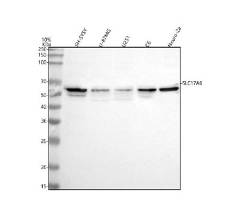 Anti-SLC17A6 / VGLUT2 / Vesicular glutamate transporter 2
