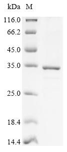 Mitochondrial thiamine pyrophosphate carrier (SLC25A19), human, recombinant
