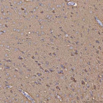 Anti-SEPHS1 / Selenophosphate synthetase 1