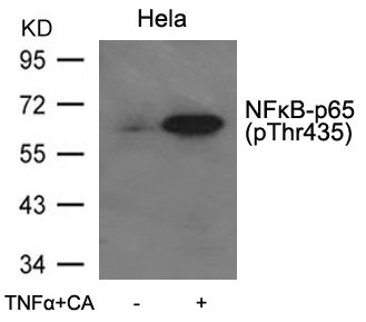 Anti-phospho-NFkB p65 (Thr435)