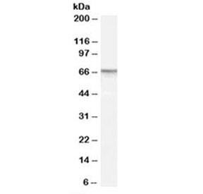 Anti-PDE11A