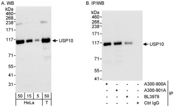 Anti-USP10