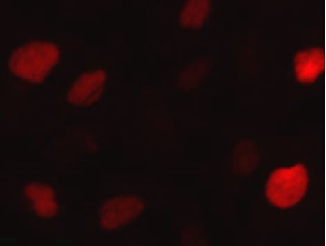 Anti-KIFC1