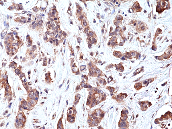 Anti-p70S6K (human), Rabbit Monoclonal (RM438)