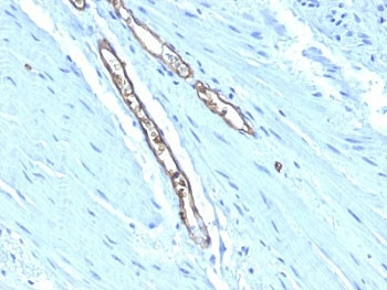 Anti-Blood group A antigen, clone HE-193