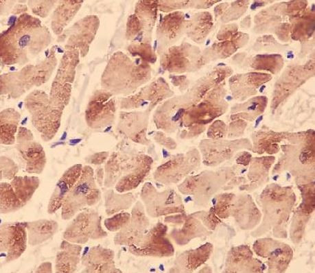 Anti-Cardiac Troponin I