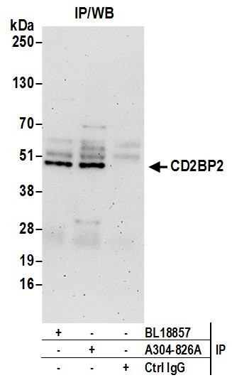 Anti-CD2BP2