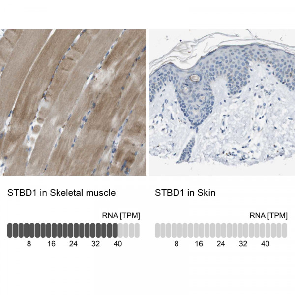 Anti-STBD1
