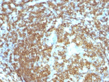 Anti-CD45RA (Leukocyte marker), clone 158-4D3