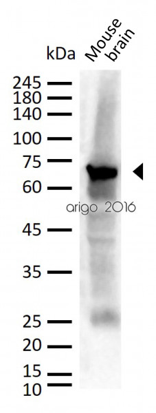 Anti-Neurofilament NF-L, clone DA2