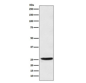 Anti-HPGD / 15-PGDH, clone AEFF-8
