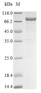 Probable ATP-dependent RNA helicase DDX53 (DDX53), human, recombinant