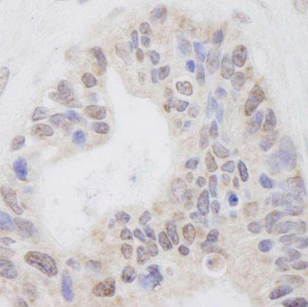 Anti-RNF40 (IHC)