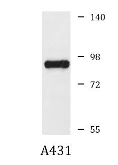 Anti-CD2AP