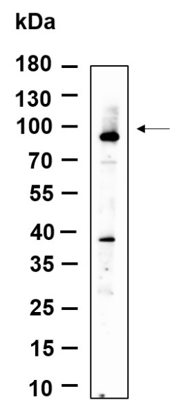 Anti-Recombinant ZNF160, clone 5D13