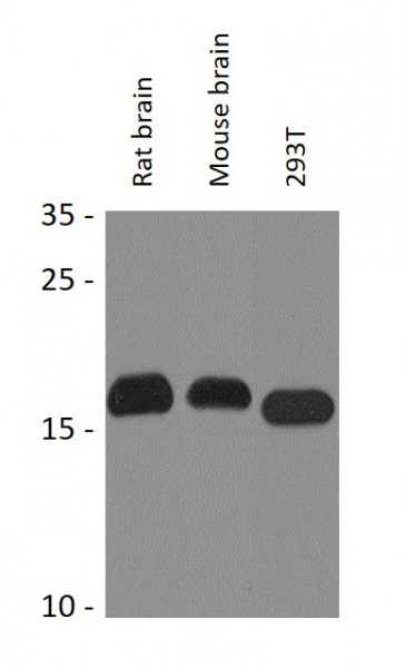 Anti-Pin 1