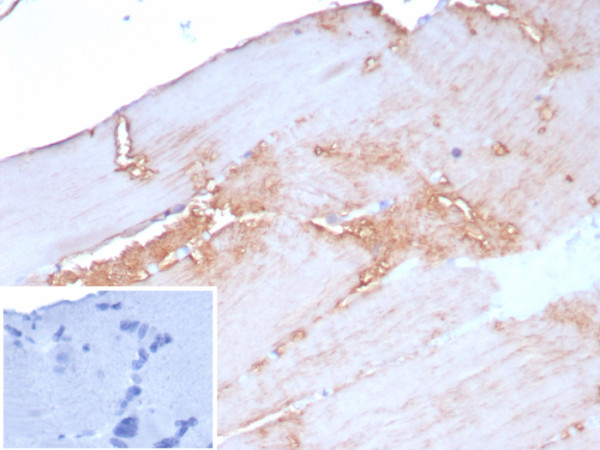 Anti-Sarcomeric Actinin Alpha 2 / ACTN2, recombinant antibody, clone rACTN2/8177