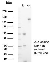 Anti-IL18R1 / Interleukin 18 receptor alpha, clone IL18R1/7592