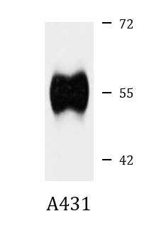 Anti-B4GALT1