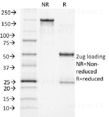 Anti-ACTH (Adrenocorticotrophic Hormone) (C-Terminus) Monoclonal Antibody (Clone: CLIP/1418)