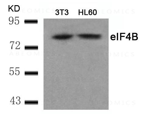 Anti-eIF4B (Ab-422)