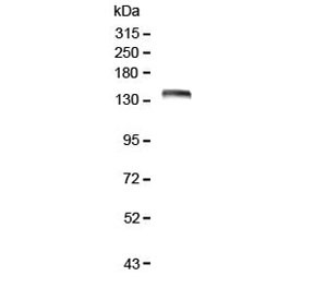 Anti-LRIG1