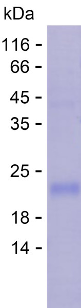 Recombinant Human EYS Protein
