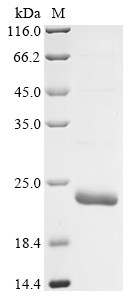 Inositol 1,4,5-triphosphate receptor associated 1 (Irag1), partial, mouse, recombinant