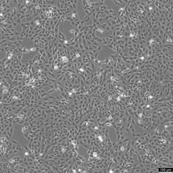 F81 Cells