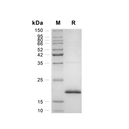 Basic Fibroblast Growth Factor (FGF-2) Recombinant (Human)