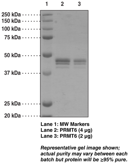 PRMT6 (human recombinant, baculovirus expressed)